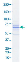 Loading 1 &mu;g protein in SDS-PAGE